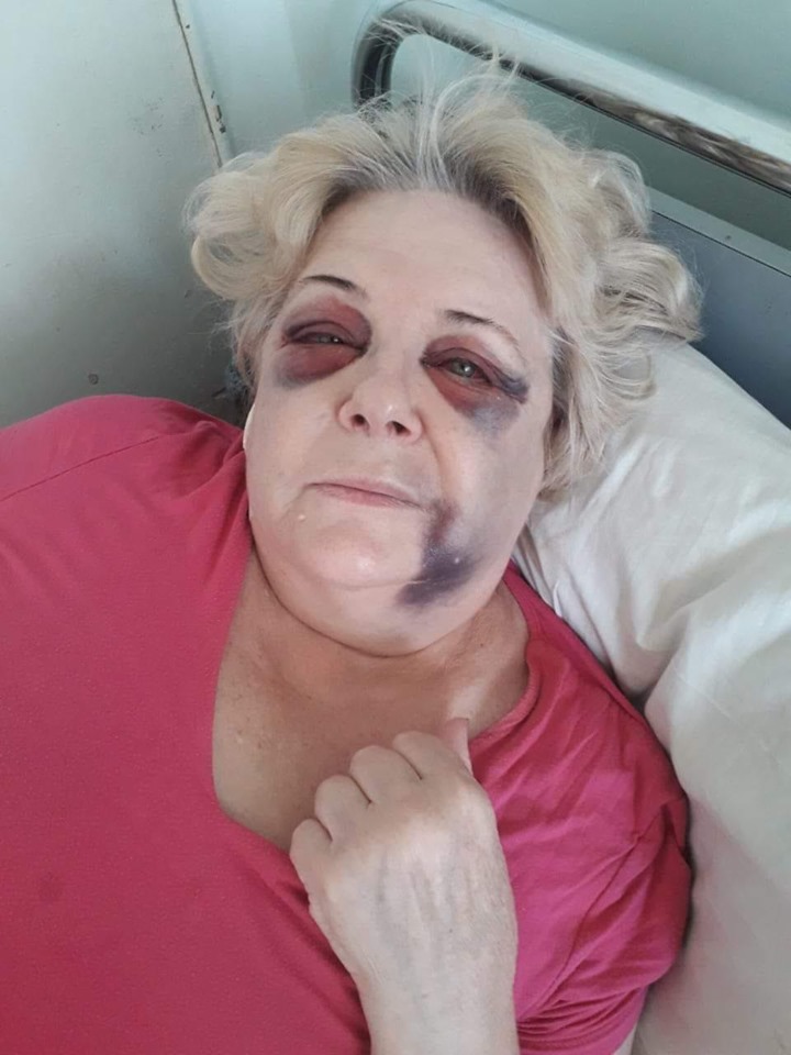 Бьет женщин по голове и срывает золото: в Киеве орудует опасный вор